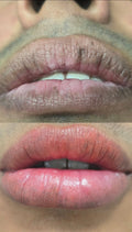 Neutralización de labios